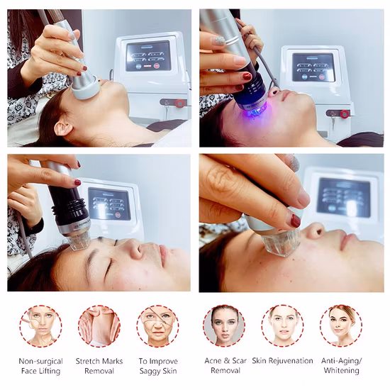 주름 스트레치 마크 제거를 강화하는 마이크로 Needling 피부 RF Microneedling 분수 RF Microneedle 분수 RF Microneedle 기계 미용 기계
